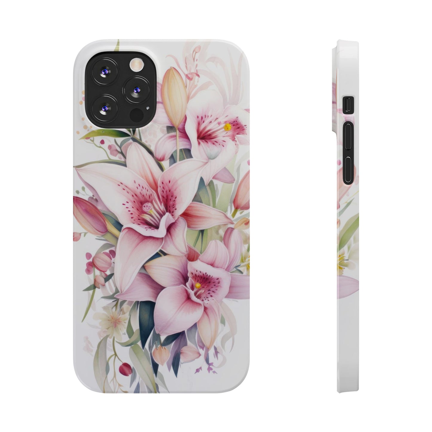 Dream Floral - iPhone Case