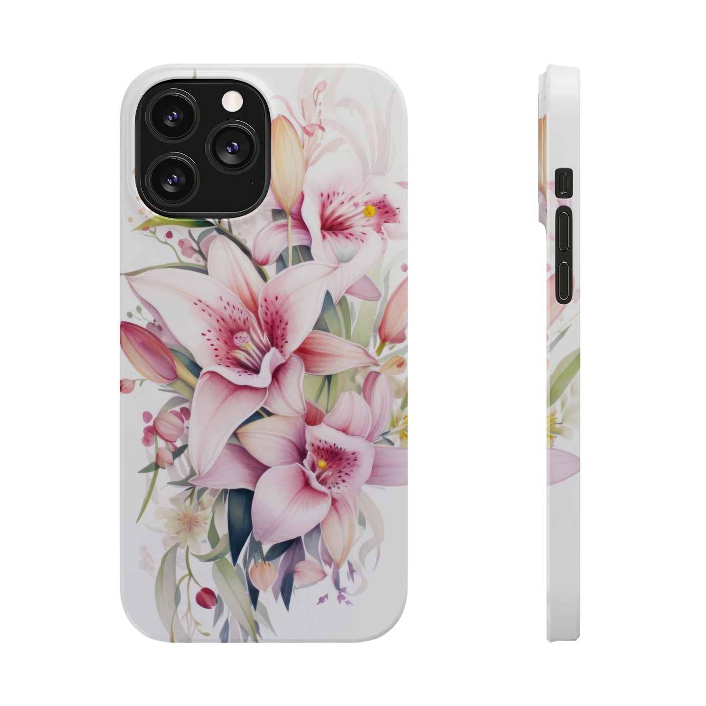 Dream Floral - iPhone Case