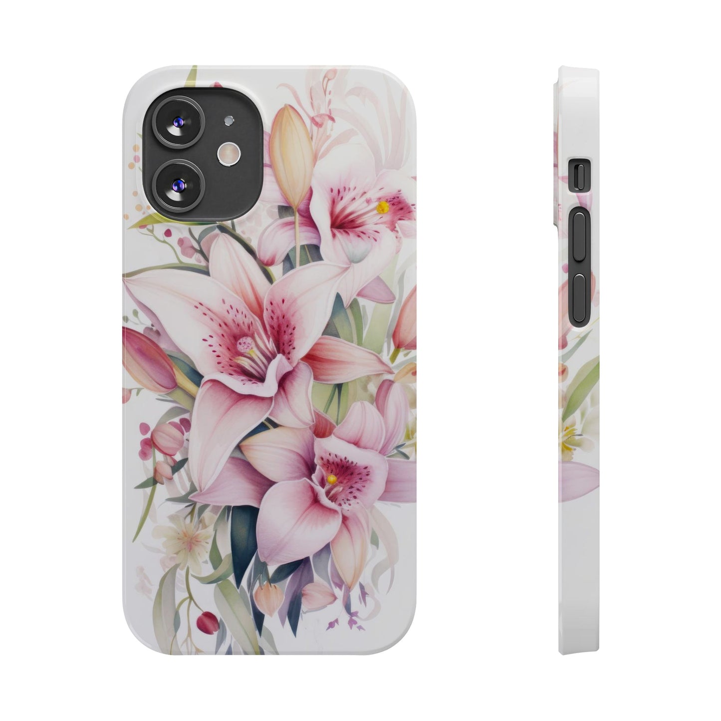 Dream Floral - iPhone Case